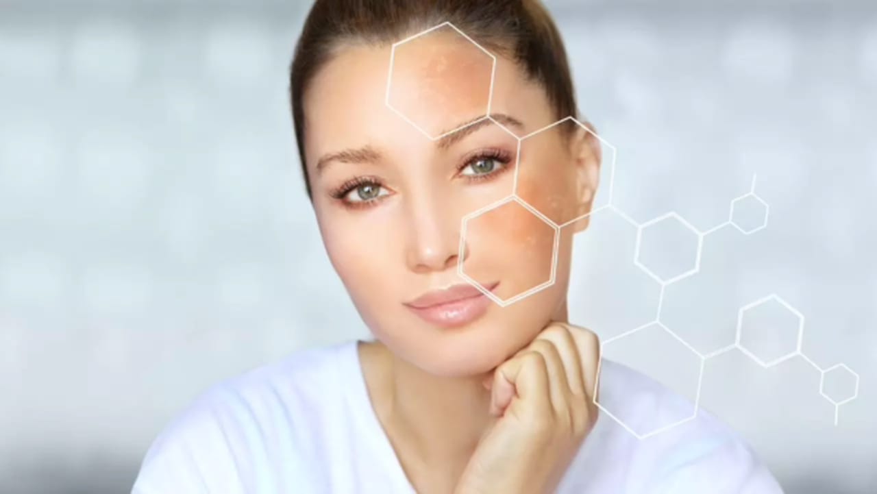 kobieta z faktura na twarzy roznice przed i po zabiegowe