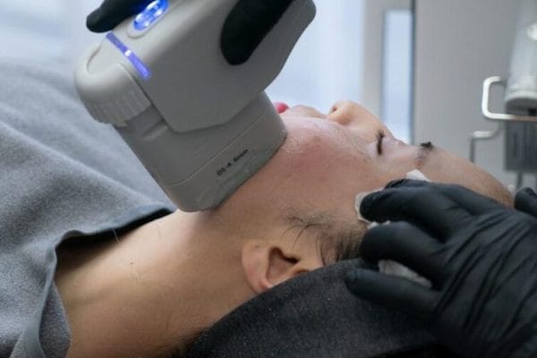 urządzenie emitujące wysoko skoncentrowaną falę ultradźwiękową.