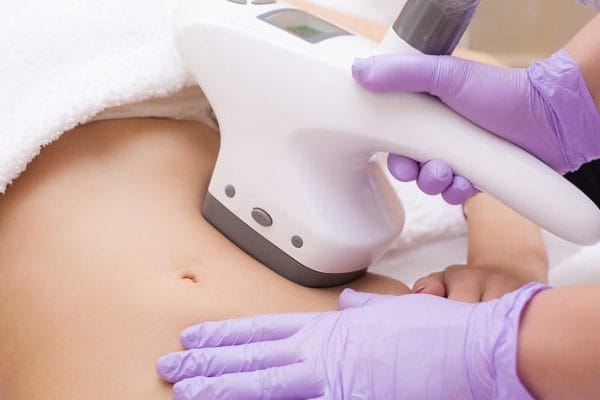 zabieg vacuum shape w trakcie, kosmetyczka przyklada glowice vacuum do brzucha klientki