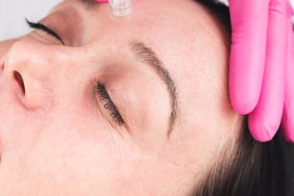 kosmetyczka przeprowadza zabieg na twarzy klientki