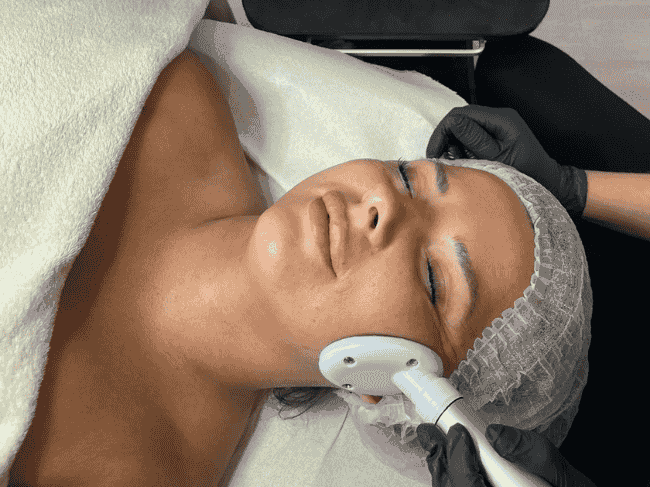 kosmetyczka wykonuje zabieg nożyczki liftingujące. Głowica urządzenia prowadzona po twarzy klientki.