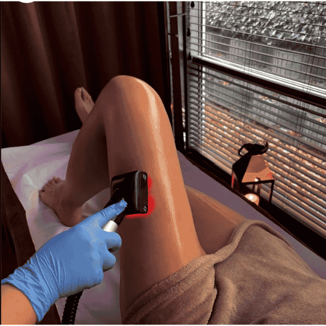 Kosmetyczka używa żelazka antycellulitowego na skórze nogi, wygładza ja.