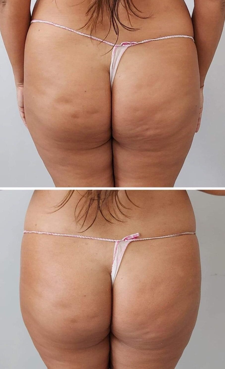 effect after one treatment abbys