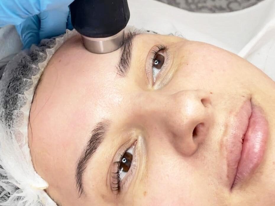 kosmetyczka przeprowadza zabieg pomocy specjalnej głowicy