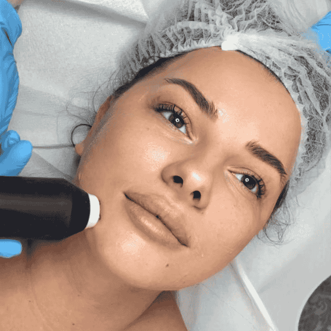 kosmetyczka przeprowadza zabieg geneo przy pomocy głowicy do fal radiowych