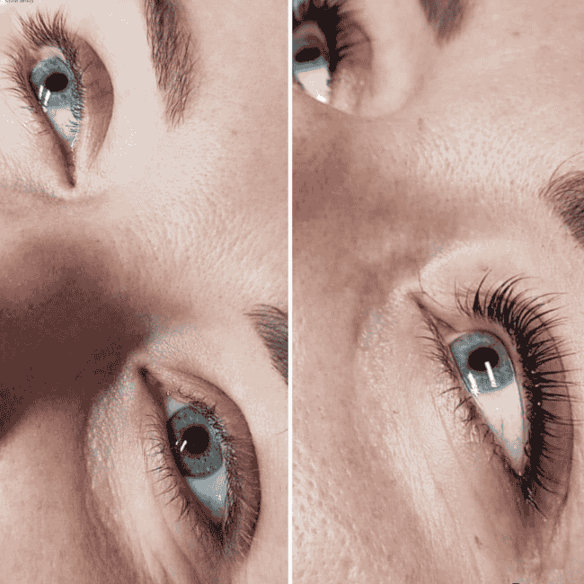 oczy przed i po liftingu rzęs