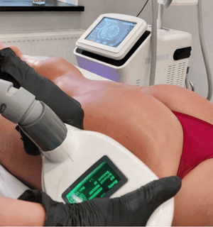 vacuum shape head guided by thigh - anti-cellulite treatment