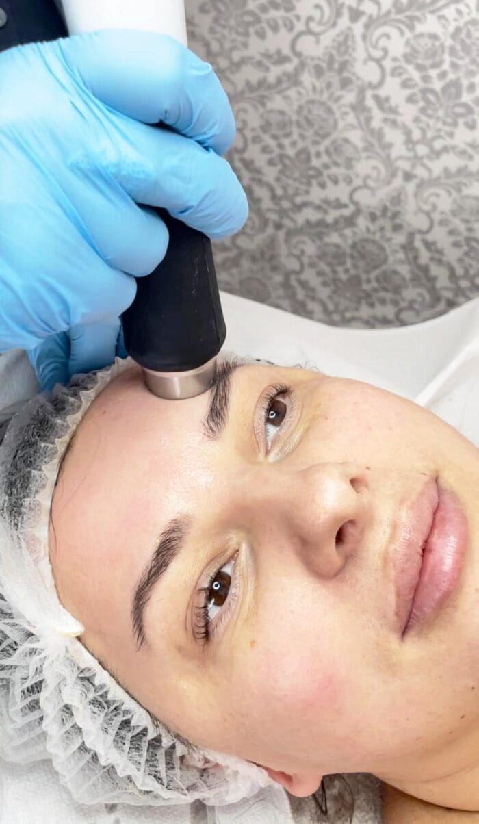 Joan during the treatment