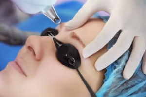 Laserowe usuwanie przebarwień 650 laserowe usuwanie przebarwień, głowica na twarzy klientki